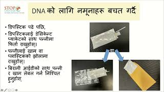 Instruction for using the dipstick test to detect V Cholerae Nepali [upl. by Leaw445]