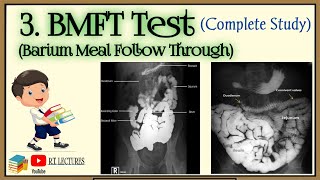 BMFT complete procedure Barium Meal Follow Through examination [upl. by Loralyn957]