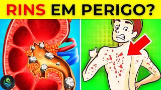 12 sinais alarmantes de que seus rins podem estar em PERIGO [upl. by Shirlie]