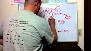 ECG Manifestations of ACS II [upl. by Ahslek722]