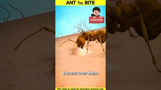 Ant 🐜 bite shorts viral [upl. by Akina]