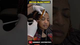 Botox Injections Treatment At Shobhit Aesthetic youtubeshorts youtubevideo [upl. by Nilyak]