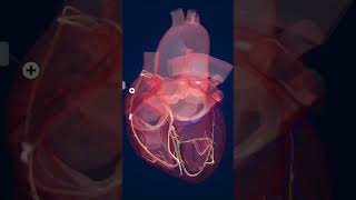 FIBRILAÇÃO ATRIAL E AVEi [upl. by Ettenel]