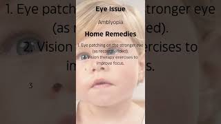 Amblyopia An Eye Issue amp Home Remedies [upl. by Jimmie]