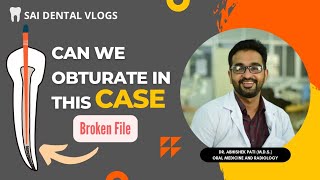 CAN WE OBTURATE WITH A BROKEN FILE INSIDE ROOT CANAL TOP 3 CAUSES [upl. by Orvas49]