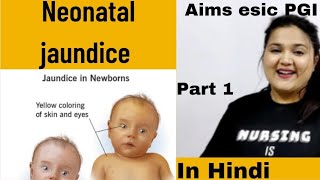 part 1 Neonatal jaundice icterus neonatorum neonatal hyperbilirubinemia  types Hindi [upl. by Vod]