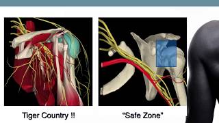 Tips for Basic Shoulder Arthroscopy Part 2 Diagnostic Routine [upl. by Trudy]