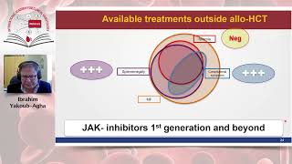 Allogeneic Stem Cell Transplantation for Myelofibrosis [upl. by Vincents]