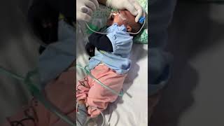 suctioning babiestour babytrendingviralshort viralvideo infants relaxation clear airway [upl. by Raseda]