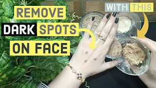 How To Remove quotDark Spotsquot Caused By Pimples Cure Black Dots On Face 2019 [upl. by Dahlstrom]