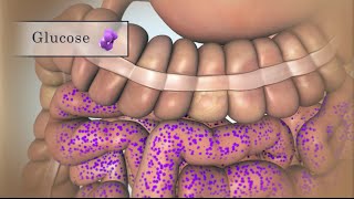 Treating Low Blood Sugar  Hypoglycemia  Nucleus Health [upl. by Bollay487]