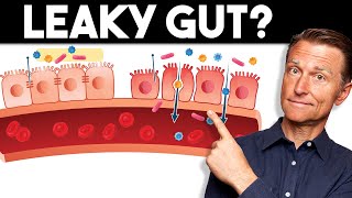 7 Signs of a Leaky Gut — Dr Berg [upl. by Meri331]