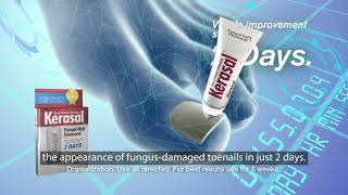 Kerasal® Fungal Nail Renewal™ Improves Appearance of Discolored or Damaged Nails [upl. by Nirb]