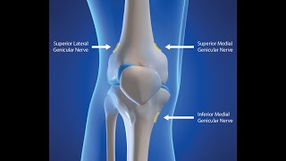 GENICULAR NERVE BLOCK [upl. by Aseret637]