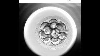 Embryoscope 2  Nuevo método de cultivo y selección embrionaria [upl. by Aziram]