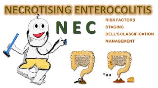 NEC  Necrotizing enterocolitis NEONATOLOGY SERIES CH6 [upl. by Judsen690]