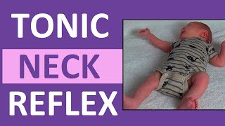 Tonic Neck Reflex in Infant Newborn  Pediatric Nursing Newborn Assessment [upl. by Jacinda]