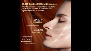 Skin Firming Facial Device Professional Home Beauty Device for Face and Body 3 Energy Levels [upl. by Ihcur]