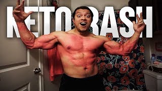 THE KETO RASH  DAY 17 ON KETO [upl. by Hibbs672]