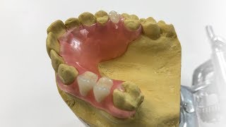 How To Make A Fiber Flex™ Partial  The Entire Process  Dental Lab Learning [upl. by Naicad]