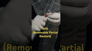 Replacement of missing teethdentaltreatment dentist dentalprocedure prosthodontics [upl. by Strawn465]