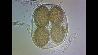 Tuber Brumale spores identification wild truffle [upl. by Annam]