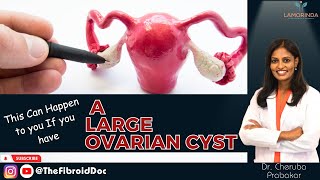 This Can Happen to you If you have A Large Ovarian Cyst  TheFibroidDoc  Dr Cheruba Prabakar [upl. by Jobi]