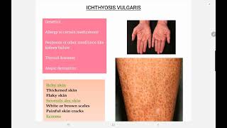 Ichthyosis Vulgaris [upl. by Atirec]