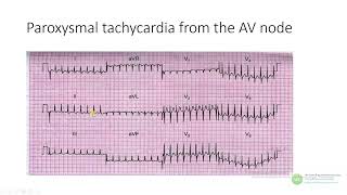 ECG interpretation [upl. by Mercola]