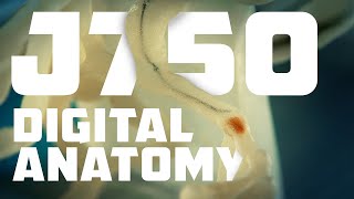 3D Printing Medical Models and Digital Anatomy with the Stratasys J750 DAP [upl. by Nylrad]