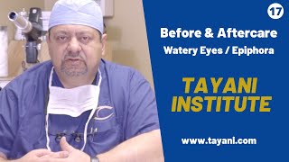 What Causes Watery Eyes  With Dr Tayani [upl. by Erbas]