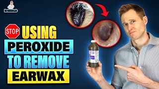 Stop Using Hydrogen Peroxide to remove Earwax [upl. by Yanad524]