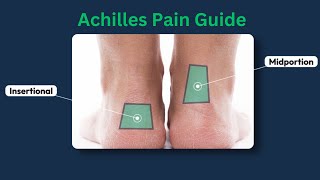 Achilles Tendinopathy  Tendinitis  Exercise  Best treatments  Recovery [upl. by Asare]