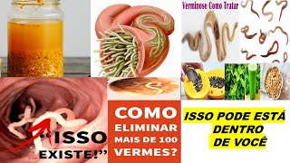 ELIMINE 100 VERMES RÁPIDO VÁRIOS TIPOS 7 RECEITAS CASEIRAS P VERMINOSE ADULTO E CRIANÇA [upl. by Aneeuqahs]