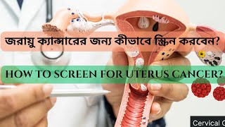 Proven HPV CIN3 PAP l জরায়ু ক্যান্সার l plenty of Koilocytes ll CYTOLOGY video drsamant [upl. by Larrej]