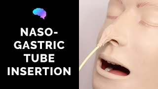 Nasogastric NG Tube Insertion  OSCE Guide  UKMLA  CPSA [upl. by Lon]