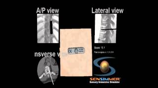 Spinal Fixation Simulation VR Haptics [upl. by Namrak]