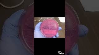 Escherichia coli E coli on MacConkey agar MAC  Clinical Microbiology shorts [upl. by Dene]