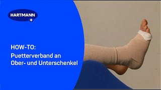 Puetterverband an Ober und Unterschenkel [upl. by Ahsenrad]