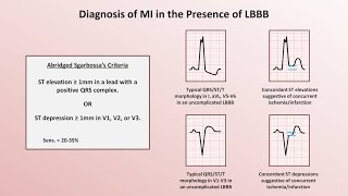 Intro to EKG Interpretation  Myocardial Infarctions Part 2 of 2 [upl. by Arihat711]