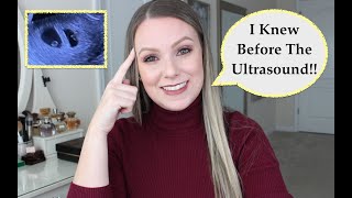 Early Signs Of Twin Pregnancy  How I Knew [upl. by Nyberg]