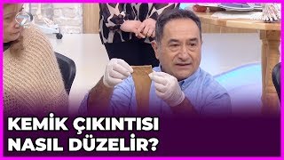 Ayakta Kemik Çıkıntısının Tedavisi Nasıl Yapılır  Feridun Kunak Show  13 Şubat 2019 [upl. by Sydney]