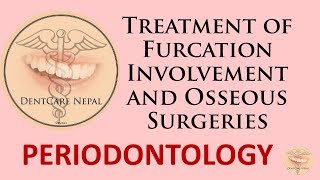 MCQS on Treatment of Furcation Involvement and Osseous surgeries  Periodontics MCQs [upl. by Katharine772]