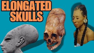 Elongated Skulls in Ancient Cultures [upl. by Ahsha]