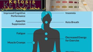 Interpretation of ketoacidosis and ketonuria [upl. by Aronoff]