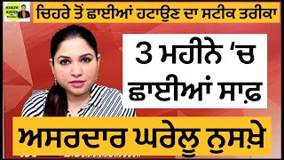 ਚਿਹਰੇ ਤੋਂ ਛਾਈਆਂ ਹਟਾਉਣ ਦਾ ਘਰੇਲੂ ਨੁਸਖ਼ਾ  Treat Pigmentation Melasma At Home  Health Advice [upl. by Nilatak544]