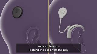 How Cochlear Implants Work [upl. by Alset120]