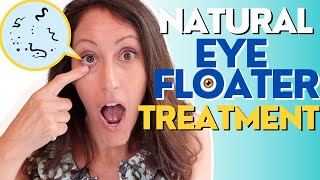 Natural Eye Floater Treatment  4 Ways to Treat Eye Floaters [upl. by Dnilasor778]