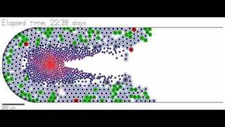 Ductal carcinoma in situ DCIS simulation [upl. by Yendys621]