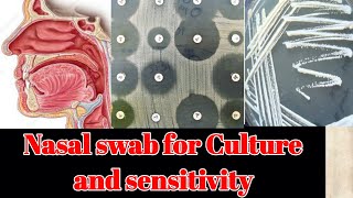 Nasal Swab for culture and sensitivity CS test [upl. by Basia]